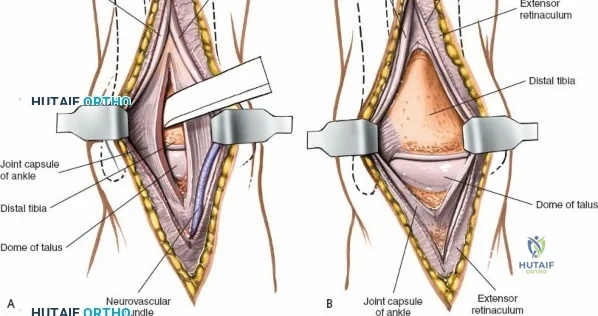 Clinical Image