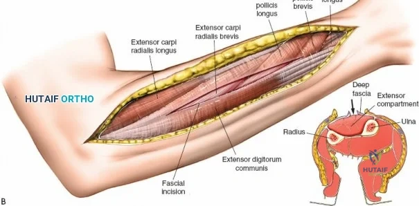 Clinical Image