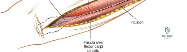 Clinical Image