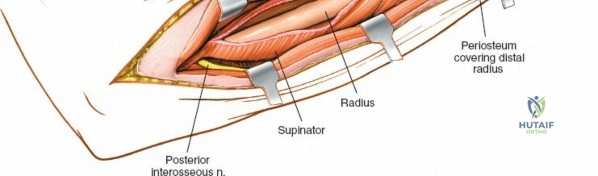 Clinical Image