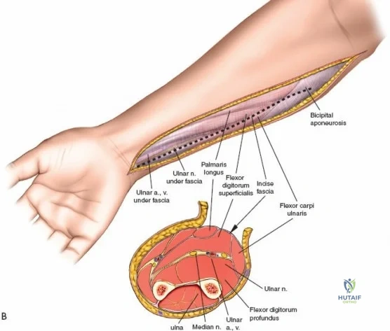 Clinical Image