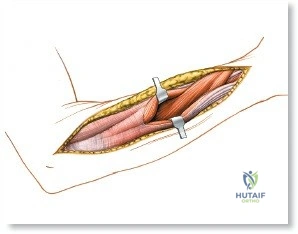 Clinical Image