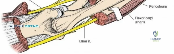 Clinical Image