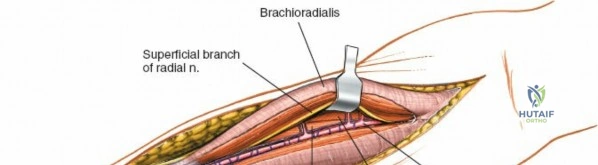 Clinical Image