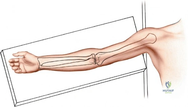 Clinical Image