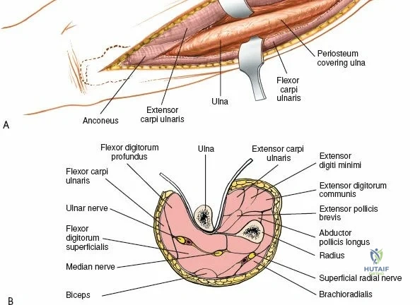 Clinical Image