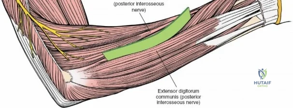 Clinical Image