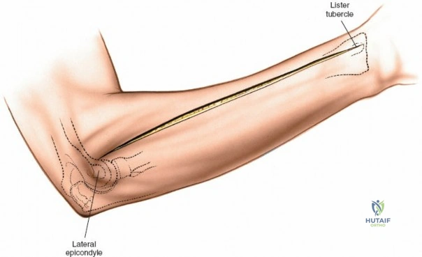 Clinical Image