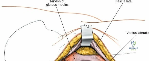 Clinical Image