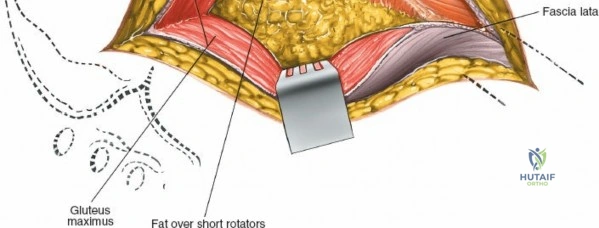 Clinical Image