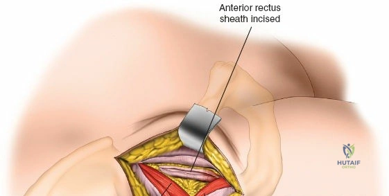 Clinical Image