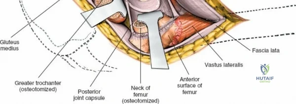 Clinical Image