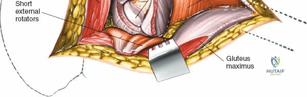Clinical Image