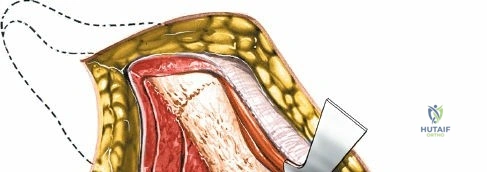 Clinical Image
