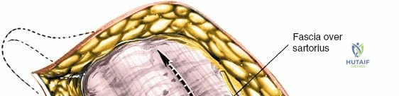 Clinical Image
