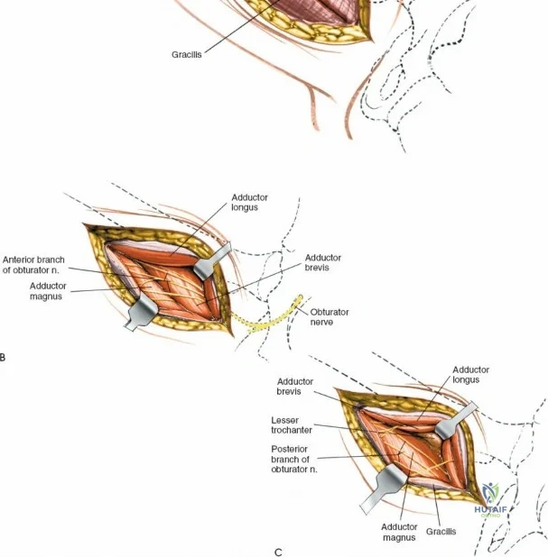 Clinical Image