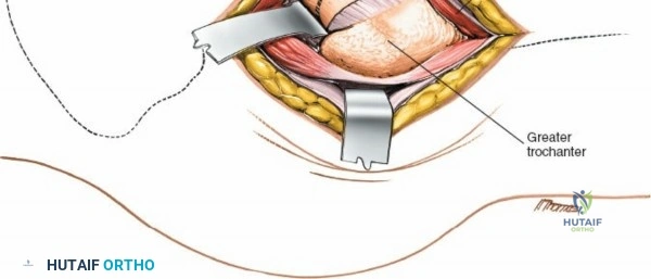 Clinical Image