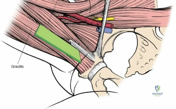 Clinical Image