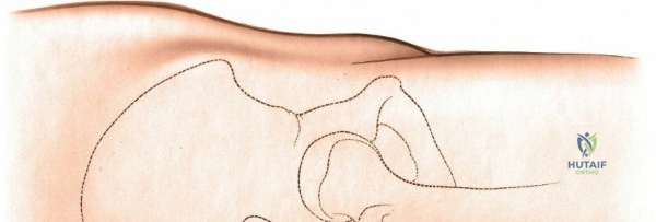 Clinical Image