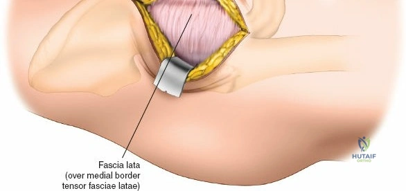 Clinical Image