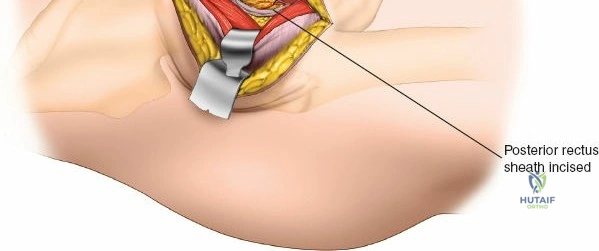Clinical Image