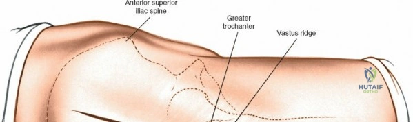 Clinical Image