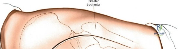 Clinical Image
