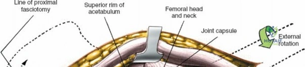 Clinical Image
