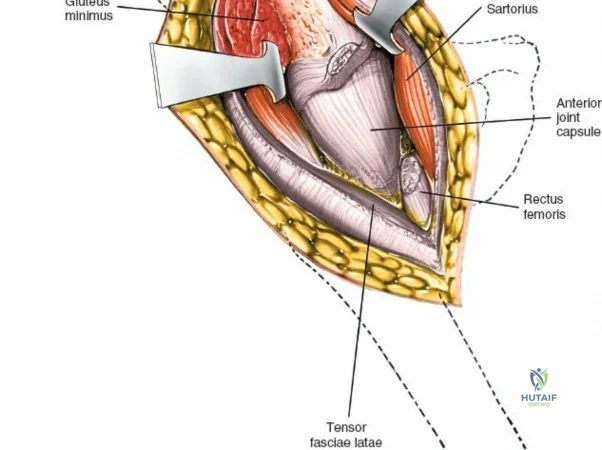 Clinical Image
