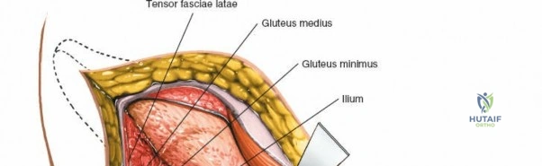 Clinical Image