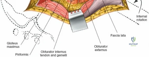 Clinical Image