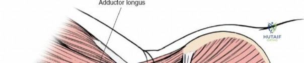 Clinical Image