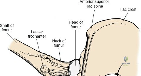 Clinical Image