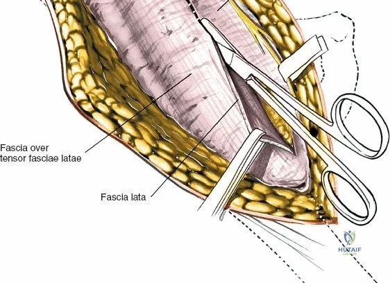Clinical Image