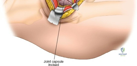 Clinical Image