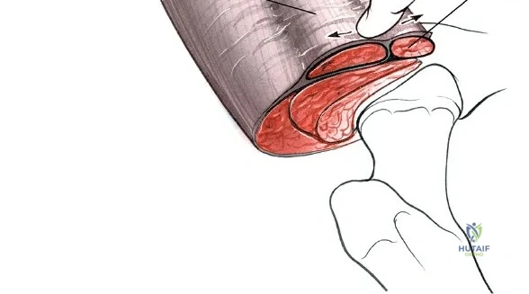 Clinical Image
