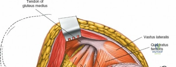 Clinical Image