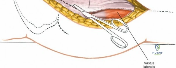 Clinical Image