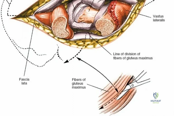 Clinical Image