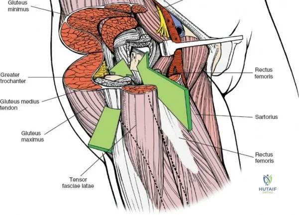 Clinical Image