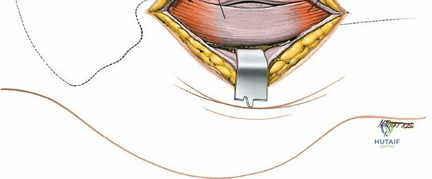 Clinical Image