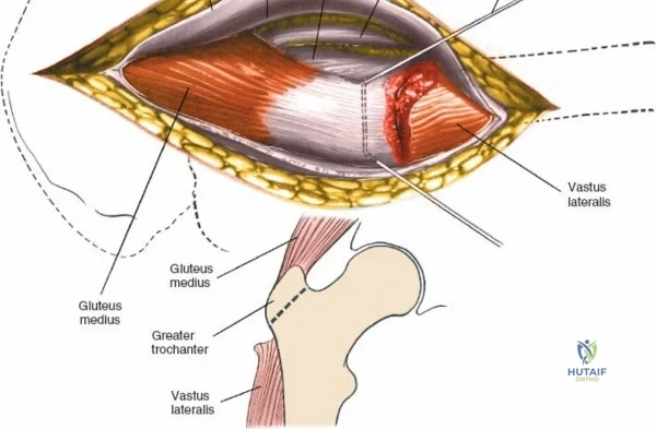 Clinical Image