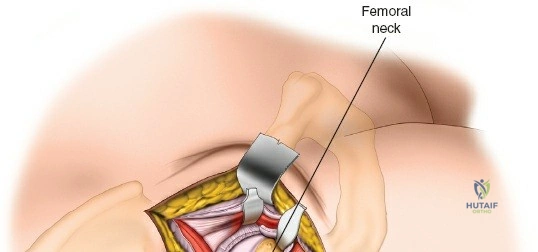 Clinical Image