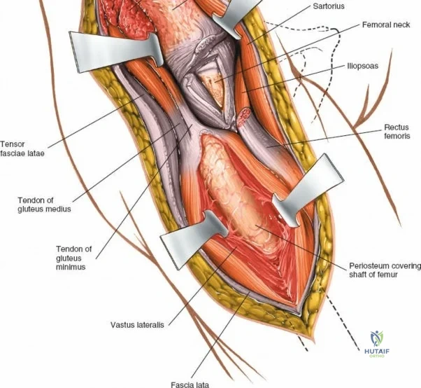 Clinical Image