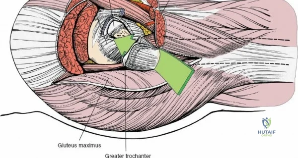 Clinical Image
