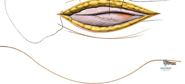 Clinical Image