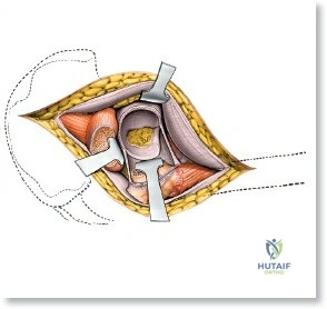 Clinical Image