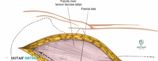 Clinical Image
