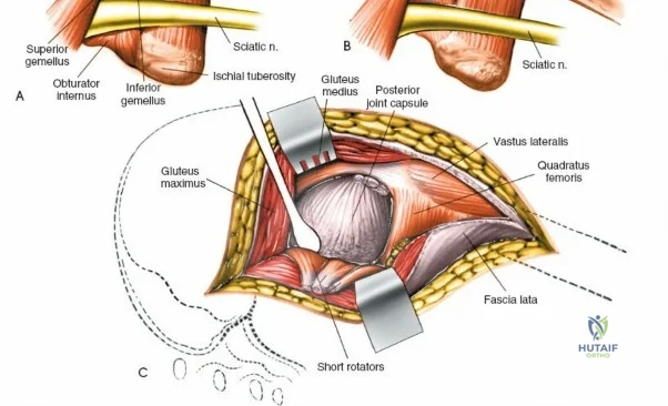 Clinical Image