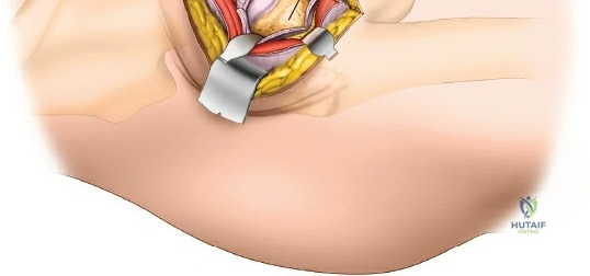 Clinical Image